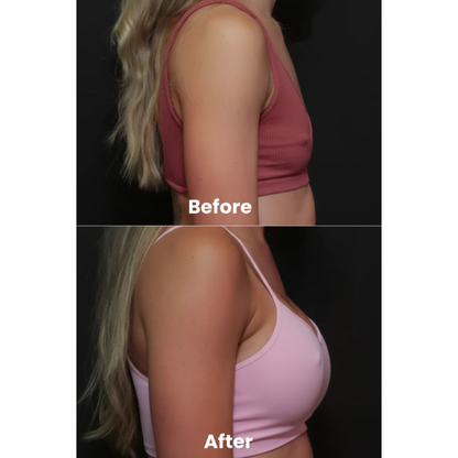 Perkia - Breast Enhancement Patches